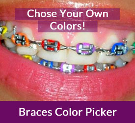 different types of braces