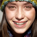 braces emergencies