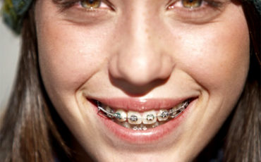 braces emergencies