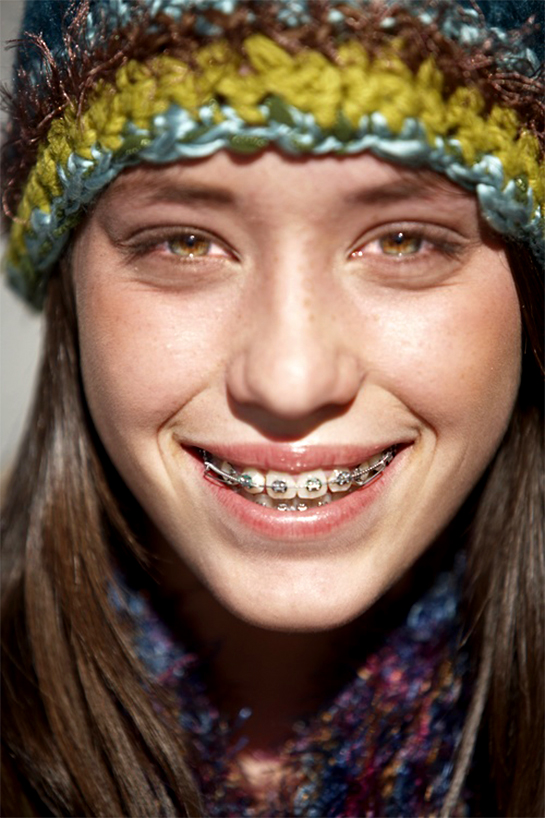 braces emergencies