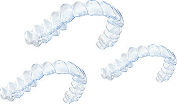Invisalign Treatment Step 3 Invisalign Treatment Step 3