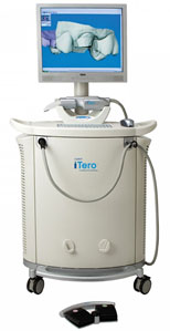 itero scanner