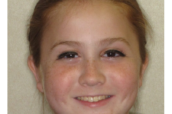 Hailey Laycock
