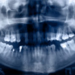 are-orthodontic-xrays-safe