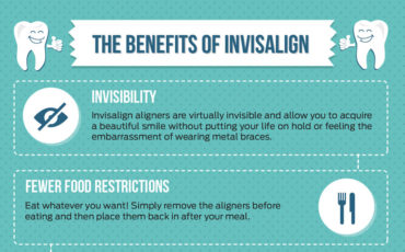 the-benefits-of-invisalign