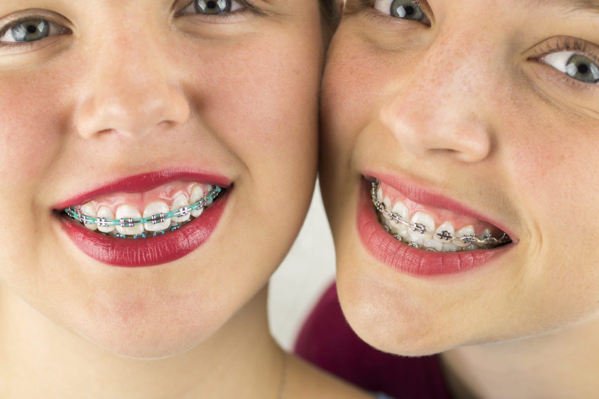 Two girls with braces posing for a photo.