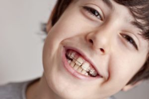 A young boy smiling with braces on his teeth.