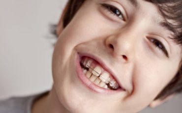 A young boy smiling with braces on his teeth.