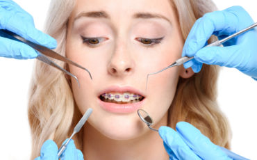 A woman with a braces on her teeth is holding a pair of tweezers.