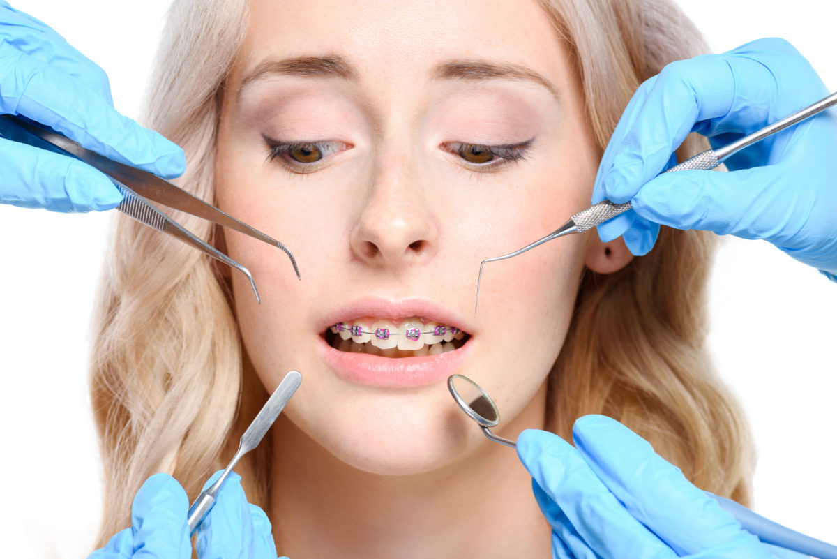 A woman with a braces on her teeth is holding a pair of tweezers.