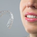 invisalign teen