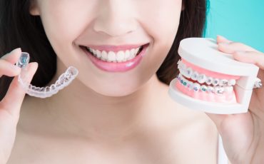 A woman holding a set of braces on a blue background.