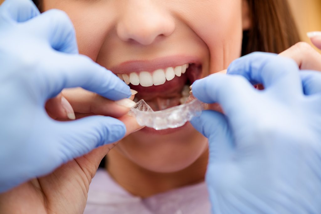 A woman is putting her braces on her teeth.