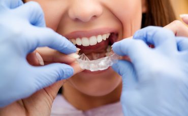 A woman is putting her braces on her teeth.