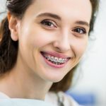 adult braces