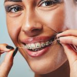 orthodontic issues