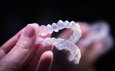 Invisalign orthodontist