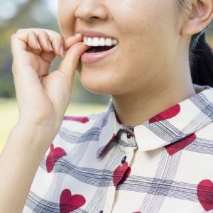 teeth aligners