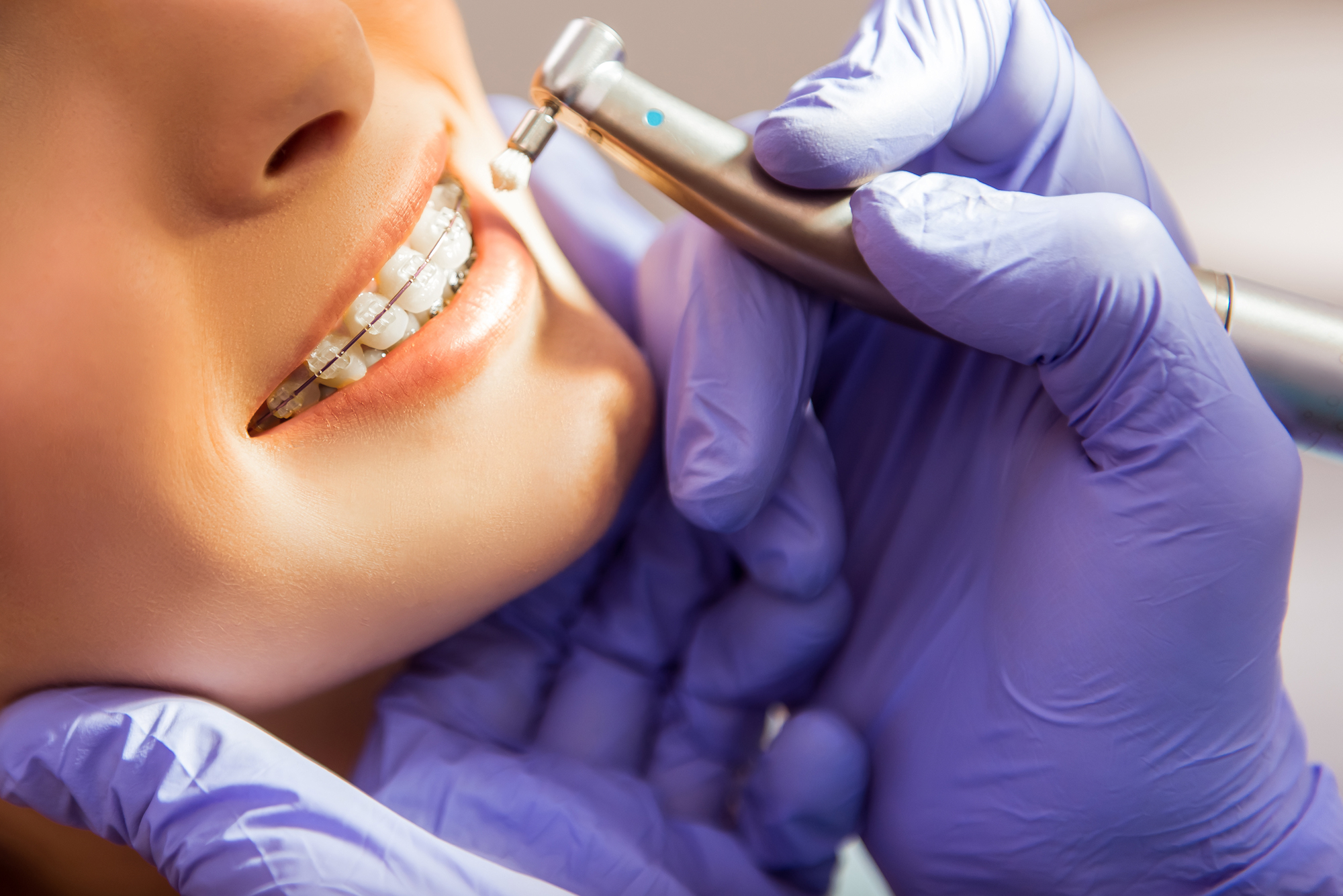 orthodontics treatment